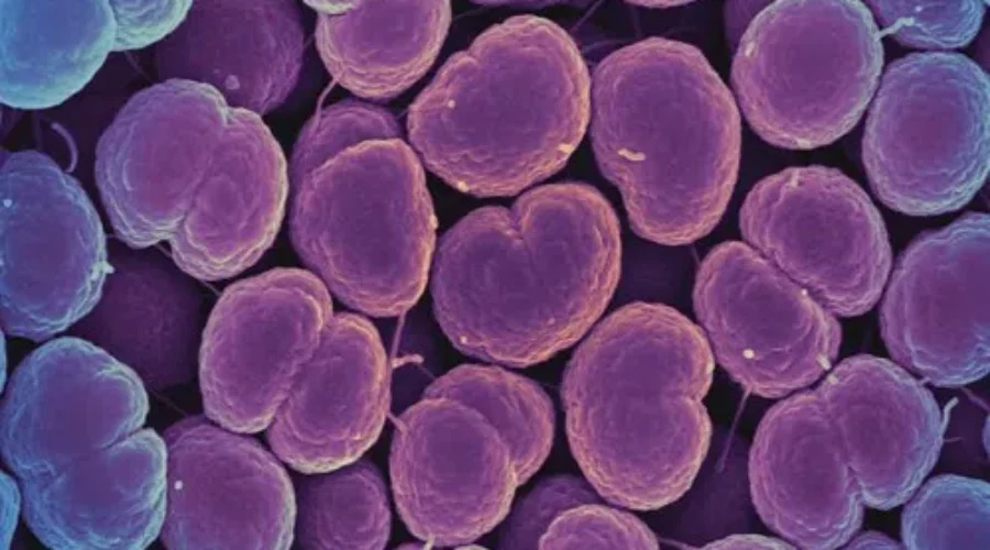 Gonorrhea On The Rise In New Brunswick