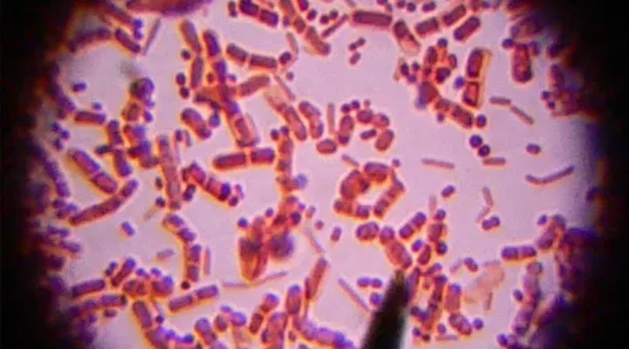 Legionellosis Confirmed In Greater Moncton