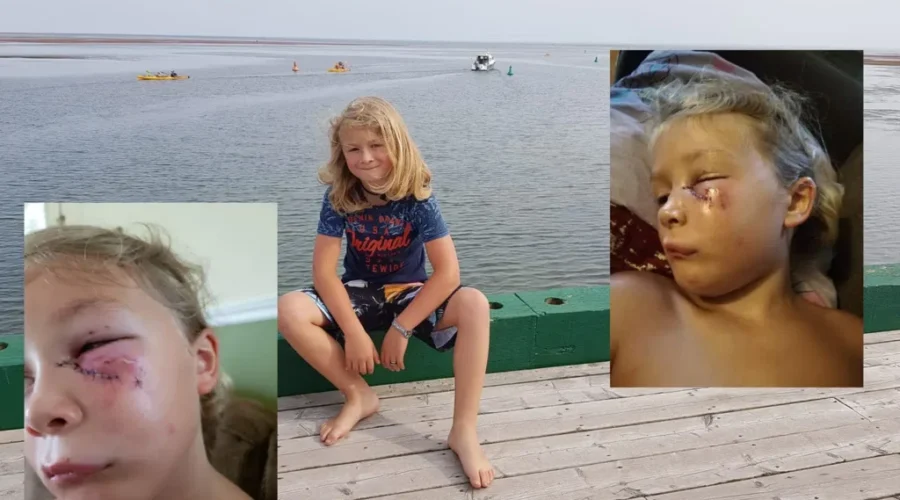 SPCA Investigating As Boy Recovers From Dog Attack