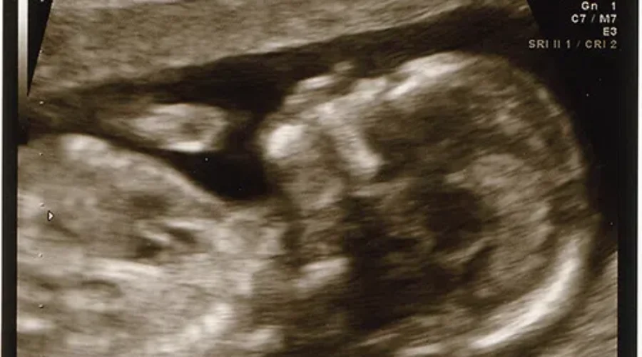 Fetal Alcohol Spectrum Disorder Awareness Campaign Launched