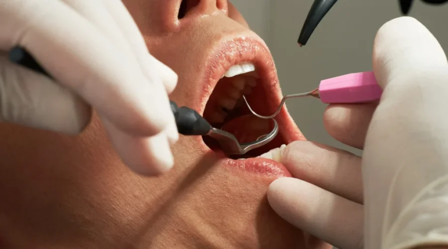 National dental plan details revealed